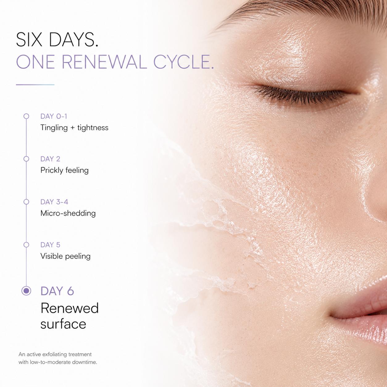 Bio-Meso PDRN Homecare Ampoule 5000 - the six-day renewal cycle, from tingling on day one to a renewed surface on day six